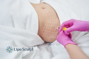 Are The Results From Aqualyx Permanent? 1 Do you want to know how long Aqualyx Sutton results last?