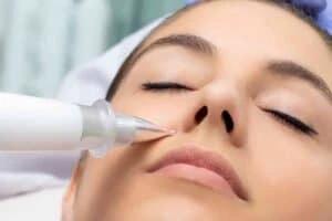 Best Actinic Keratoses Removal 3 Actinic keratoses Sutton solutions - book in today!